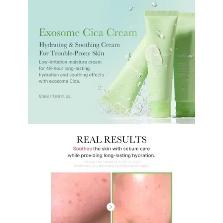 MEDICUBE CRÈME EXOSOME CICA