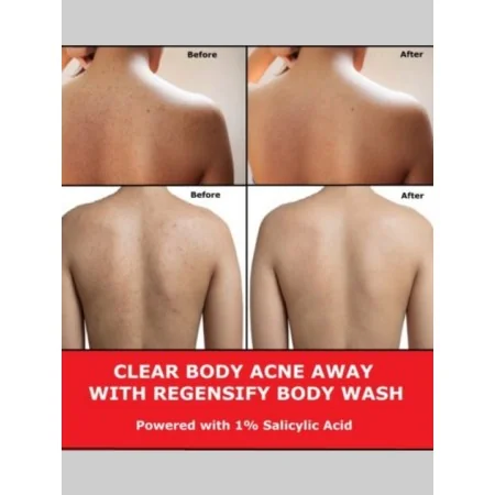 MEDICUBE RED ACNE GEL DOUCHE