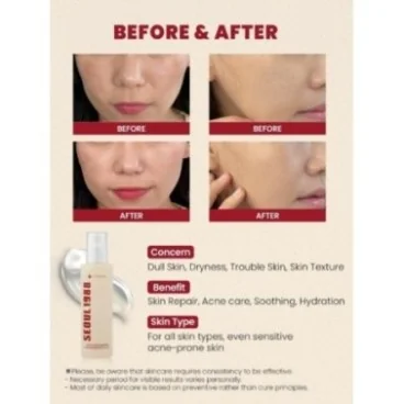 SEOUL 1988 ESSENCE MUCINE D'ESCARGOT 97% + RIZ