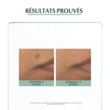 EUCERIN DERMOPURE SERUM TRIPLE ACTION 40ML