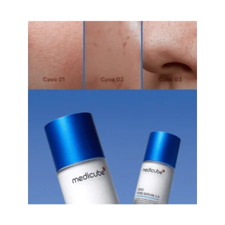 MEDICUBE ZERO PORE SÉRUM