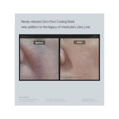 MEDICUBE ZERO PORE MASQUE RAFRAÎCHISSANT