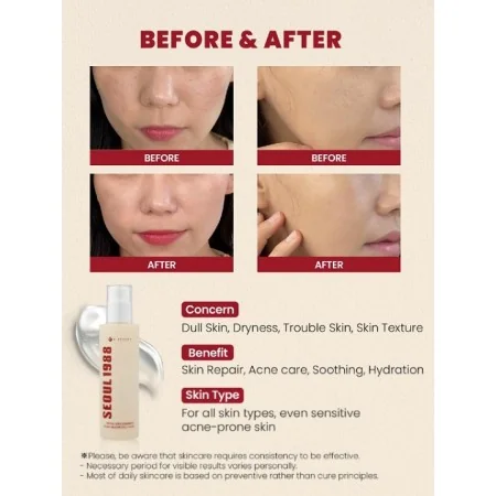 SEOUL 1988 ESSENCE MUCINE D'ESCARGOT 97% + RIZ