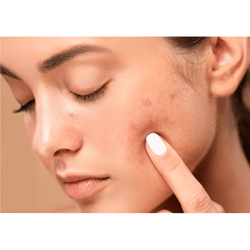 2- THE GLOW EXPERIENCES SOIN MAT & GLOW PEAUX MIXTES À GRASSES (PREMIUM)