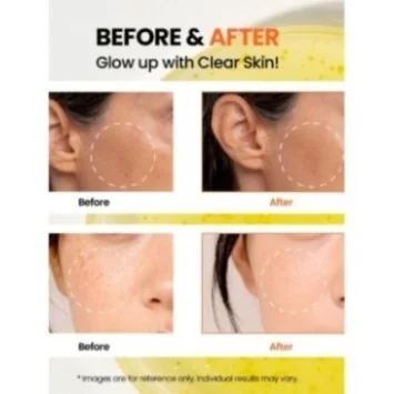 SEOUL 1988 SERUM : NIACINAMIDE 15% + YUJA