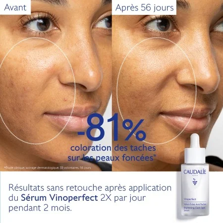 CAUDALIE VINOPERFECT SÉRUM ÉCLAT ANTI-TACHES 30ML