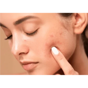 2- THE GLOW EXPERIENCES SOIN MAT & GLOW PEAUX MIXTES À GRASSES (PREMIUM)