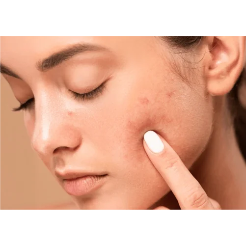 2- THE GLOW EXPERIENCES SOIN MAT & GLOW PEAUX MIXTES À GRASSES (PREMIUM)