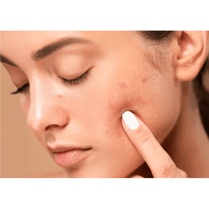 2- THE GLOW EXPERIENCES SOIN MAT & GLOW PEAUX MIXTES À GRASSES (PREMIUM)